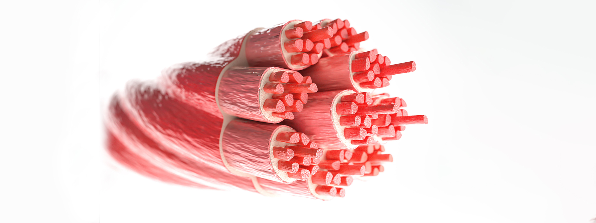Muscle Injuries in Sport