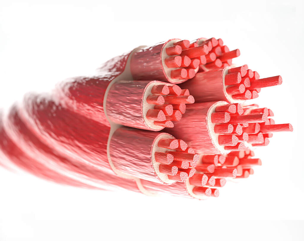 Muscle Injuries in Sport